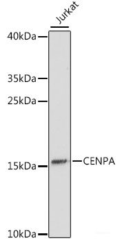 Immunohistochemistry of paraffin-embedded Human lung cancer using CDX2 Polyclonal Antibody at dilution of 1:100 (40x lens).
