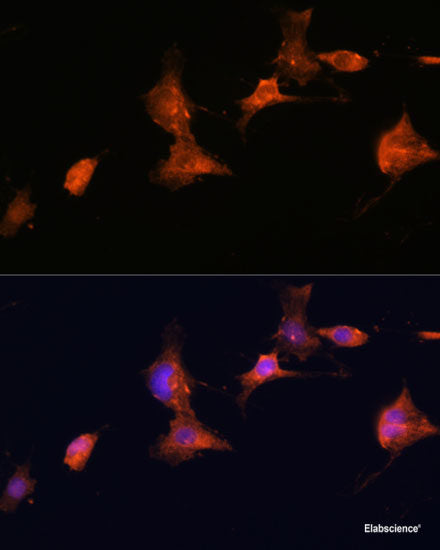 Western blot analysis of extracts from normal (control) and FSP1/S100A4 knockout (KO) HeLa cells using FSP1/S100A4 Polyclonal Antibody at dilution of 1:1000.