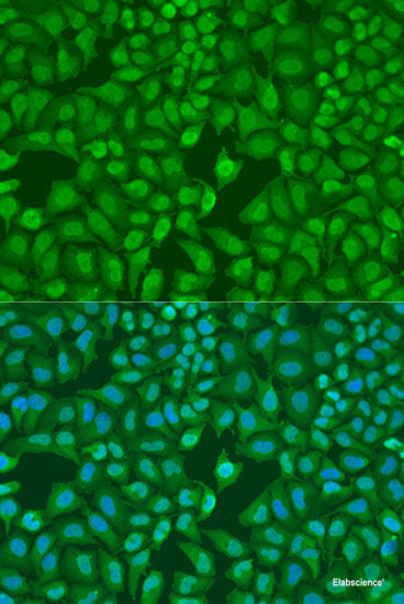 Western blot analysis of extracts of Rat thymus using FUNDC1 Polyclonal Antibody at dilution of 1:1000.