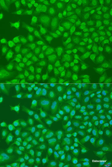 Immunofluorescence analysis of HeLa cells using DTNBP1 Polyclonal Antibody