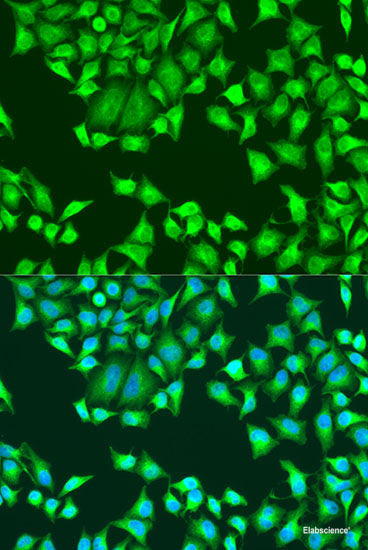 Immunohistochemistry of paraffin-embedded Human small intestine using HMGCR Polyclonal Antibody at dilution of 1:200 (40x lens).