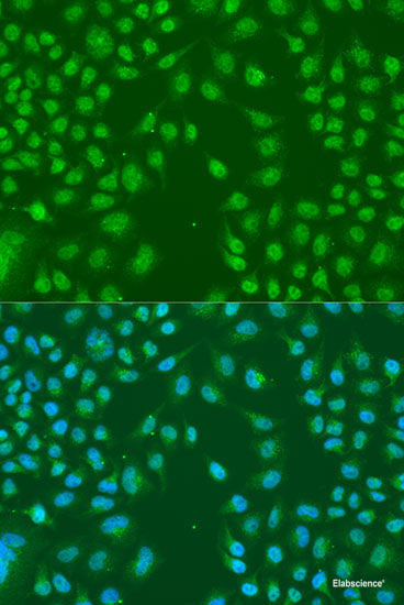 Immunohistochemistry of paraffin-embedded Mouse liver using COMP Polyclonal Antibody at dilution of 1:100 (40x lens).