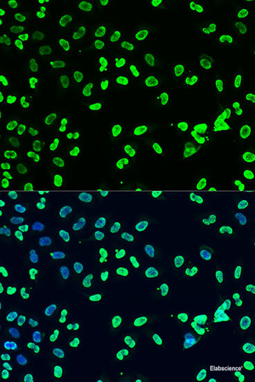 Western blot analysis of extracts from normal (control) and HSPB1 knockout (KO) HeLa cells using HSPB1 Polyclonal Antibody at dilution of 1:1000.