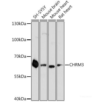 Immunohistochemistry of paraffin-embedded Human placenta using A2M Polyclonal Antibody at dilution of 1:100 (40x lens).