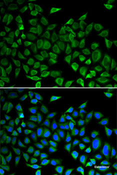 Immunofluorescence analysis of C6 cells using AEBP1 Polyclonal Antibody at dilution of 1:100 (40x lens). Blue: DAPI for nuclear staining.