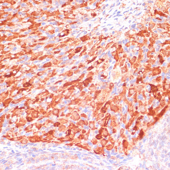 Immunofluorescence analysis of HeLa cells using ARF1 Polyclonal Antibody at dilution of 1:100. Blue: DAPI for nuclear staining.