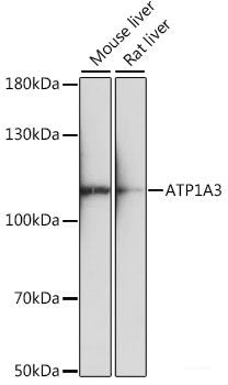 Immunofluorescence analysis of HeLa cells using ARAF Polyclonal Antibody at dilution of 1:100. Blue: DAPI for nuclear staining.