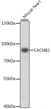 Western blot analysis of extracts of SKOV3 cells using AMFR Polyclonal Antibody at dilution of 1:1000.
