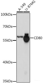 Immunofluorescence analysis of C6 cells using ARL3 Polyclonal Antibody at dilution of 1:100 (40x lens). Blue: DAPI for nuclear staining.