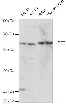 Immunohistochemistry of paraffin-embedded Human stomach using HMGA1 Polyclonal Antibody at dilution of 1:100 (40x lens).