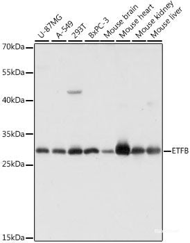 Immunofluorescence analysis of C6 cells using ATP6V0C Polyclonal Antibody at dilution of 1:100 (40x lens). Blue: DAPI for nuclear staining.
