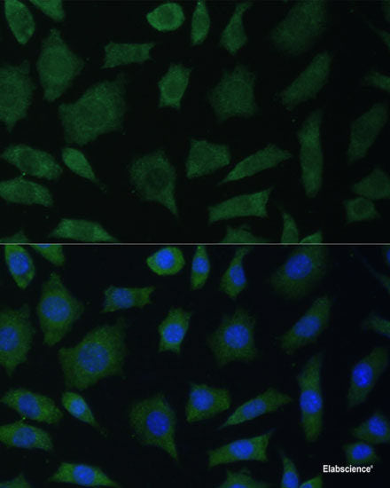 Immunofluorescence analysis of HeLa cells using BMP1 Polyclonal Antibody at dilution of 1:100. Blue: DAPI for nuclear staining.