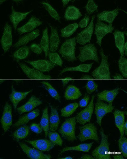 Western blot analysis of extracts of Rat heart using CMKLR1 Polyclonal Antibody at dilution of 1:1000.