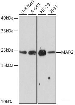 Immunohistochemistry of paraffin-embedded Rat lung using CYP11A1 Polyclonal Antibody at dilution of 1:100 (40x lens).