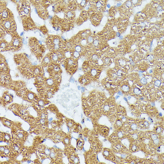 Immunohistochemistry of paraffin-embedded Human colon carcinoma using HBEGF Polyclonal Antibody at dilution of 1:100 (40x lens).