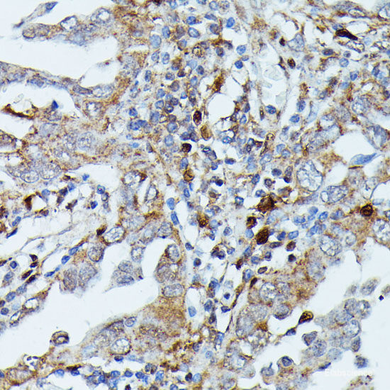 Immunofluorescence analysis of HeLa cells using ENO3 Polyclonal Antibody at dilution of 1:100. Blue: DAPI for nuclear staining.