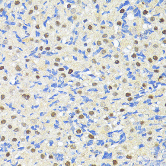 Immunohistochemistry of paraffin-embedded Rat heart using FLNA Polyclonal Antibody at dilution of 1:100 (40x lens).