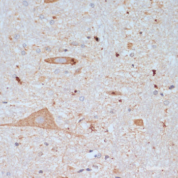 Immunohistochemistry of paraffin-embedded Rat testis using MSH6 Polyclonal Antibody at dilution of 1:100 (40x lens).