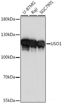 Immunohistochemistry of paraffin-embedded Human colon carcinoma using KRT13 Polyclonal Antibody at dilution of 1:100 (40x lens).