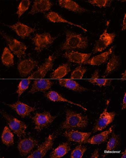 Western blot analysis of extracts of Mouse kidney using MEF2D Polyclonal Antibody at dilution of 1:1000.