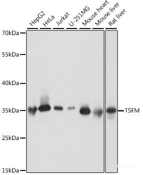 Immunohistochemistry of paraffin-embedded Mouse testis using CAMP Polyclonal Antibody at dilution of 1:200 (40x lens).