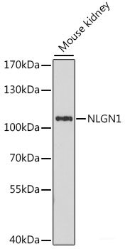 Immunofluorescence analysis of Mouse brain using NEFM Polyclonal Antibody at dilution of 1:100. Blue: DAPI for nuclear staining.