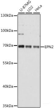 Western blot analysis of extracts of various cell lines using NINJ1 Polyclonal Antibody at dilution of 1:1000.