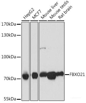 Immunohistochemistry of paraffin-embedded Human placenta using NMT1 Polyclonal Antibody at dilution of 1:100 (40x lens).