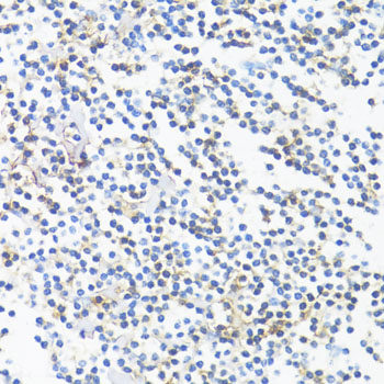 Immunofluorescence analysis of U2OS cells using CTNND1 Polyclonal Antibody