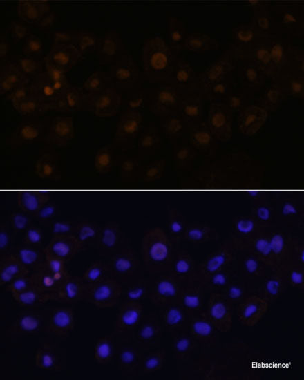 Western blot analysis of extracts of Rat liver using PRDX1 Polyclonal Antibody at dilution of 1:1000.