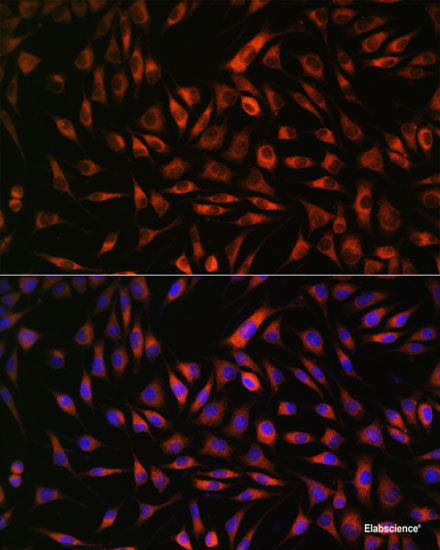 Immunofluorescence analysis of U-2 OS cells using PRSS8 Polyclonal Antibody at dilution of 1:100. Blue: DAPI for nuclear staining.