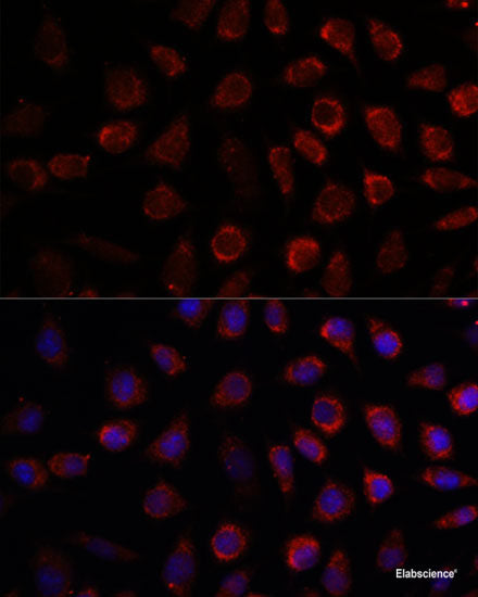 Western blot analysis of extracts of various cell lines using RGS4 Polyclonal Antibody at dilution of 1:1000.