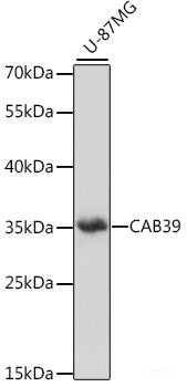 Immunohistochemistry of paraffin-embedded Human thyroid cancer using MRPL23 Polyclonal Antibody at dilution of 1:100 (40x lens).