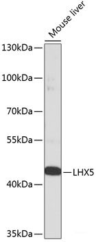 Western blot analysis of extracts of Mouse lung using RTN1 Polyclonal Antibody at dilution of 1:1000.