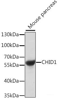 Immunohistochemistry of paraffin-embedded Rat liver using SAA4 Polyclonal Antibody at dilution of 1:100 (40x lens).