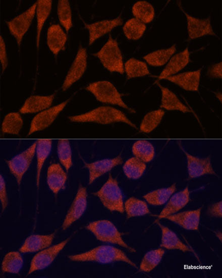Western blot analysis of extracts of various cell lines using SCD Polyclonal Antibody at dilution of 1:1000.