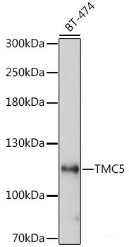 Immunohistochemistry of paraffin-embedded Rat lung using DEFB4A Polyclonal Antibody at dilution of 1:100 (40x lens).
