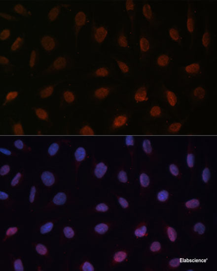 Immunofluorescence analysis of L929 cells using STAR Polyclonal Antibody at dilution of 1:100 (40x lens). Blue: DAPI for nuclear staining.