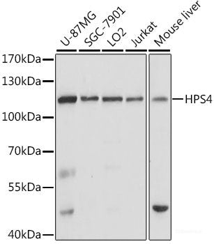 Immunofluorescence analysis of U-2 OS cells using SUPT6H Polyclonal Antibody at dilution of 1:100. Blue: DAPI for nuclear staining.