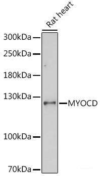 Immunofluorescence analysis of HeLa cells using TBP Polyclonal Antibody at dilution of 1:100 (40x lens). Blue: DAPI for nuclear staining.