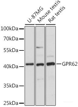 Immunohistochemistry of paraffin-embedded Rat spleen using CD11A Polyclonal Antibody at dilution of 1:100 (40x lens).
