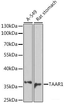 Western blot analysis of extracts of various cell lines using TOP2A Polyclonal Antibody at dilution of 1:1000.