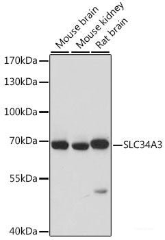 Immunofluorescence analysis of HeLa cells using FXR1 Polyclonal Antibody at dilution of 1:100. Blue: DAPI for nuclear staining.