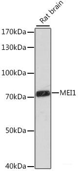 Immunofluorescence analysis of RAW264.7 cells using PD-L1 Polyclonal Antibody at dilution of 1:100. Blue: DAPI for nuclear staining.