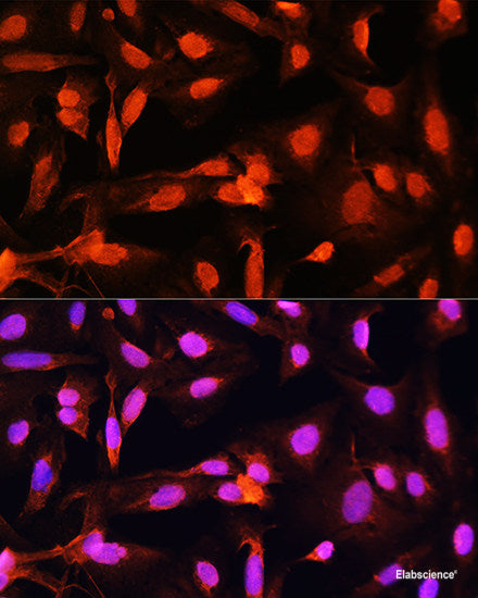 Western blot analysis of extracts of Rat kidney using TNFSF12 Polyclonal Antibody at dilution of 1:1000.