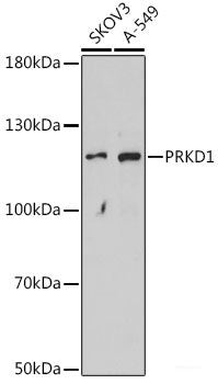 Immunohistochemistry of paraffin-embedded Rat ovary using PLAA Polyclonal Antibody at dilution of 1:100 (40x lens).