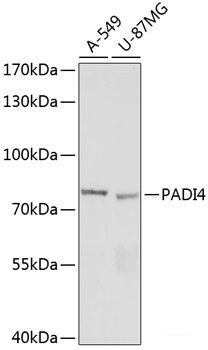 Western blot analysis of extracts of various cell lines using PARP2 Polyclonal Antibody at dilution of 1:1000.