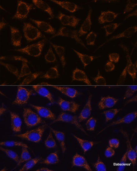 Western blot analysis of extracts of Mouse kidney using CHRNA4 Polyclonal Antibody at dilution of 1:1000.