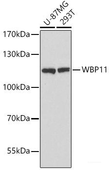 Western blot analysis of extracts of various cells using Heparanase 1 Polyclonal Antibody at dilution of 1:1000.