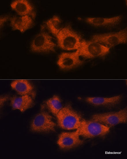 Western blot analysis of extracts of Rat lung using GLIPR1 Polyclonal Antibody at dilution of 1:1000.